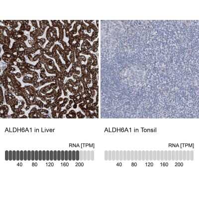 Immunohistochemistry-Paraffin: ALDH6A1 Antibody [NBP1-82635]