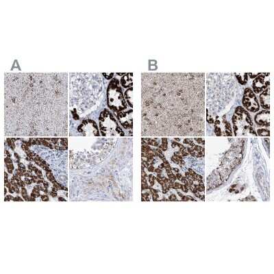 Immunohistochemistry-Paraffin: ALDH6A1 Antibody [NBP1-82635]
