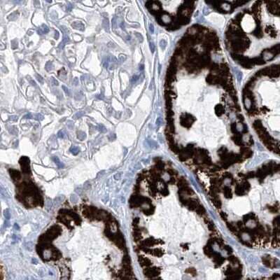 Immunohistochemistry-Paraffin: ALDH6A1 Antibody [NBP1-82635]