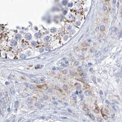 Immunohistochemistry-Paraffin: ALDH6A1 Antibody [NBP1-82635]