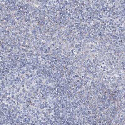 Immunohistochemistry-Paraffin: ALDH6A1 Antibody [NBP1-82636]