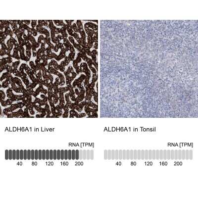 Immunohistochemistry-Paraffin: ALDH6A1 Antibody [NBP1-82636]