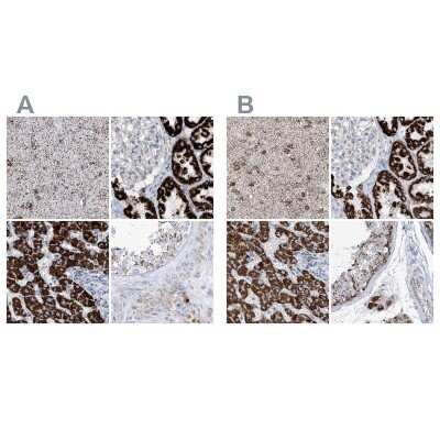 Immunohistochemistry-Paraffin: ALDH6A1 Antibody [NBP1-82636]