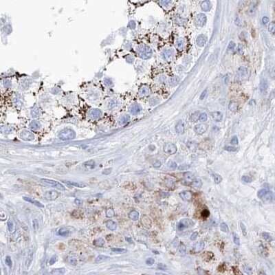 Immunohistochemistry-Paraffin: ALDH6A1 Antibody [NBP1-82636]