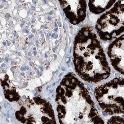 Immunohistochemistry-Paraffin: ALDH6A1 Antibody [NBP1-82636]