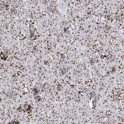 Immunohistochemistry-Paraffin: ALDH6A1 Antibody [NBP1-82636]