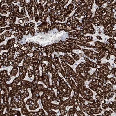 Immunohistochemistry-Paraffin: ALDH6A1 Antibody [NBP1-82637]