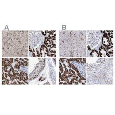 Immunohistochemistry-Paraffin: ALDH6A1 Antibody [NBP1-82637]