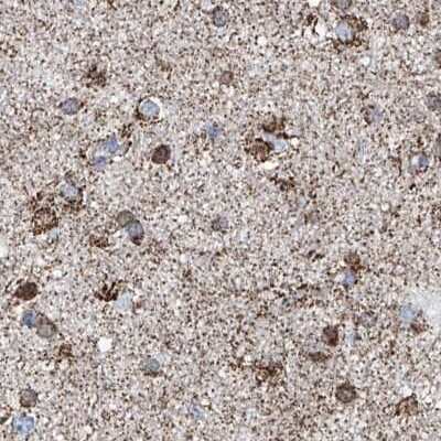 Immunohistochemistry-Paraffin: ALDH6A1 Antibody [NBP1-82637]