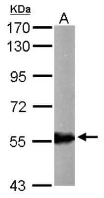 Western Blot: ALDH6A1 Antibody [NBP1-32381]