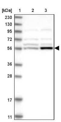 Western Blot: ALDH6A1 Antibody [NBP1-82635]