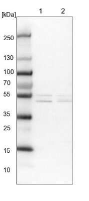Western Blot: ALDH6A1 Antibody [NBP1-82636]