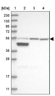 Western Blot: ALDH6A1 Antibody [NBP1-82637]