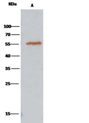 Immunoprecipitation: ALDH7A1 Antibody (105) [NBP2-89927]