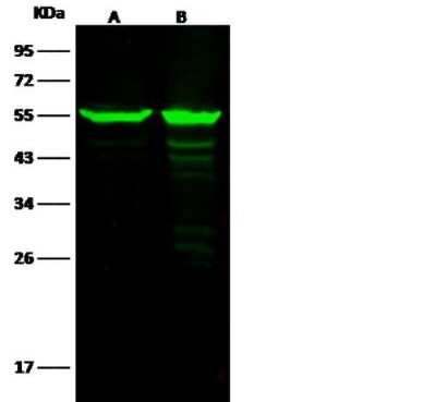 Western Blot: ALDH7A1 Antibody (105) [NBP2-89927]