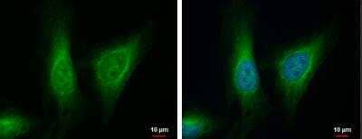 Immunocytochemistry/ Immunofluorescence: ALDH7A1 Antibody [NBP2-15343]