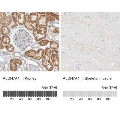 Immunohistochemistry-Paraffin: ALDH7A1 Antibody [NBP1-88908]