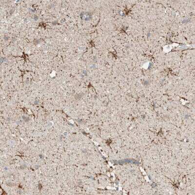 Immunohistochemistry-Paraffin: ALDH7A1 Antibody [NBP1-88908]