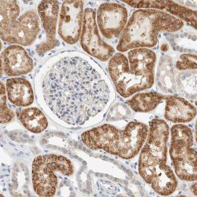 Immunohistochemistry-Paraffin: ALDH7A1 Antibody [NBP1-88908]