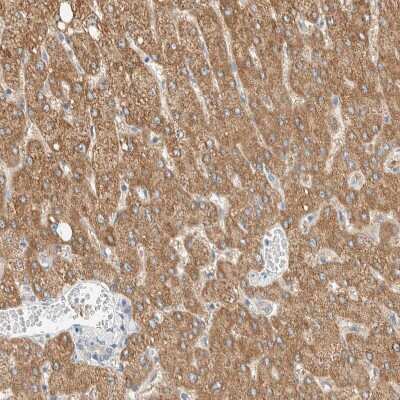 Immunohistochemistry-Paraffin: ALDH7A1 Antibody [NBP1-88908]