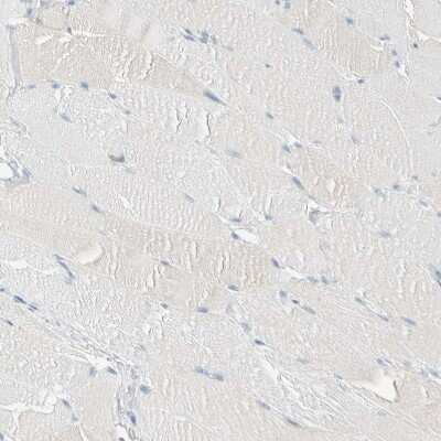 Immunohistochemistry-Paraffin: ALDH7A1 Antibody [NBP1-88908]