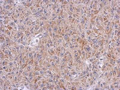 Immunohistochemistry-Paraffin: ALDH7A1 Antibody [NBP2-15342]