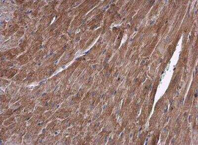 Immunohistochemistry-Paraffin: ALDH7A1 Antibody [NBP2-15342]