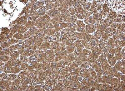 Immunohistochemistry-Paraffin: ALDH7A1 Antibody [NBP2-15343]