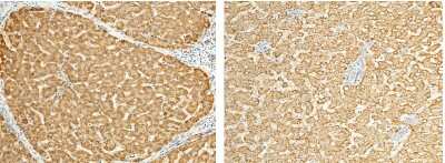 Immunohistochemistry-Paraffin: ALDH7A1 Antibody [NBP2-99843]