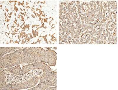 Immunohistochemistry-Paraffin: ALDH7A1 Antibody [NBP2-99843]