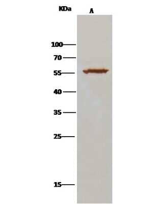 Immunoprecipitation: ALDH7A1 Antibody [NBP2-99843]