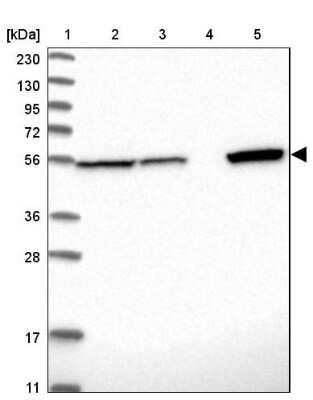 Western Blot: ALDH7A1 Antibody [NBP1-88908]