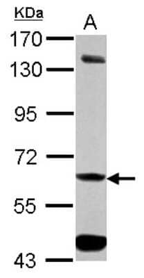 Western Blot: ALDH7A1 Antibody [NBP2-15342]