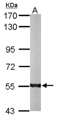 Western Blot: ALDH7A1 Antibody [NBP2-15343]