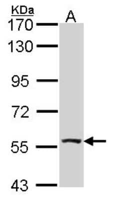 Western Blot: ALDH7A1 Antibody [NBP2-15343]