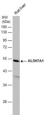 Western Blot: ALDH7A1 Antibody [NBP2-15343]