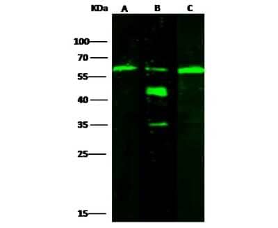 Western Blot: ALDH7A1 Antibody [NBP2-99843]