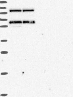 Western Blot: ALDH7A1 Antibody [NBP3-17010]