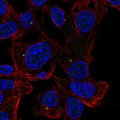 Immunocytochemistry/ Immunofluorescence: ALDH8A1 Antibody [NBP2-38753]