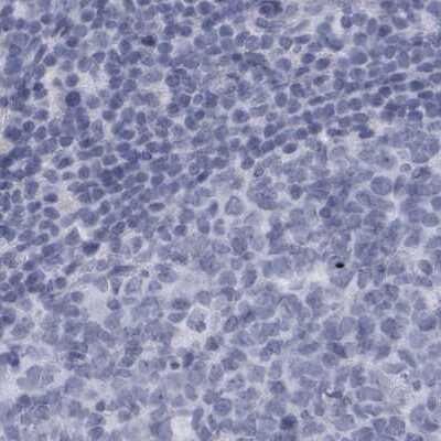 Immunohistochemistry-Paraffin: ALDH8A1 Antibody [NBP1-89151]