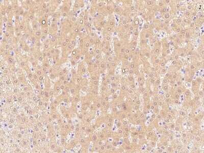 Immunohistochemistry-Paraffin: ALDH8A1 Antibody [NBP2-99392]