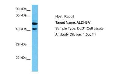 Western Blot: ALDH8A1 Antibody [NBP2-84419]