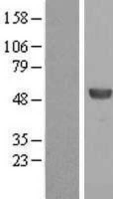 Western Blot: ALDH8A1 Overexpression Lysate [NBP2-06426]