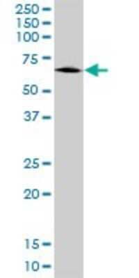 Western Blot: ALDH9A1 Antibody (3C6) [H00000223-M01]