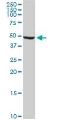 Western Blot: ALDH9A1 Antibody (3C6) [H00000223-M01]