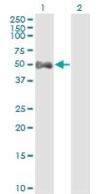 Western Blot: ALDH9A1 Antibody (3C6) [H00000223-M01]