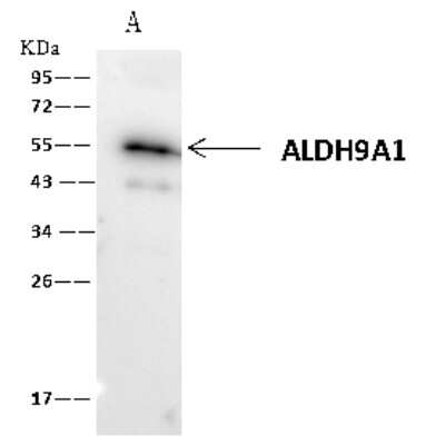 Immunoprecipitation: ALDH9A1 Antibody [NBP2-99130]