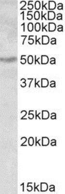 Western Blot: ALDH9A1 Antibody [NBP1-52055]