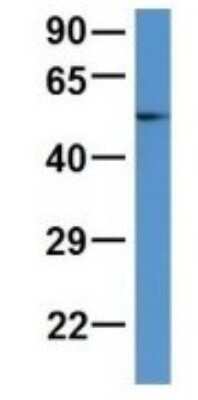 Western Blot: ALDH9A1 Antibody [NBP1-69138]