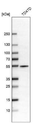 Western Blot: ALDH9A1 Antibody [NBP1-89150]